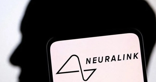 The First Person to Have Neuralink Chip Implanted in the Brain Can Play Games on a Laptop with Their Thoughts